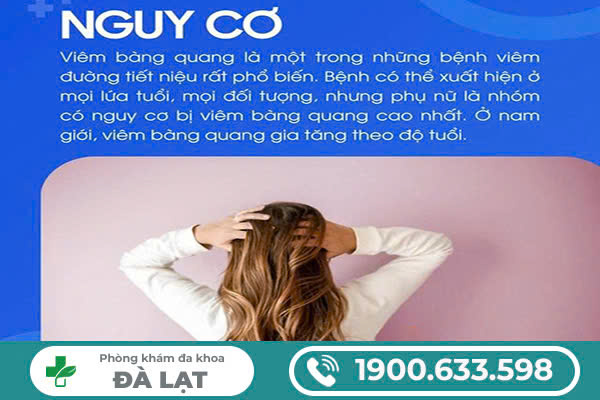 Hình ảnh minh họa